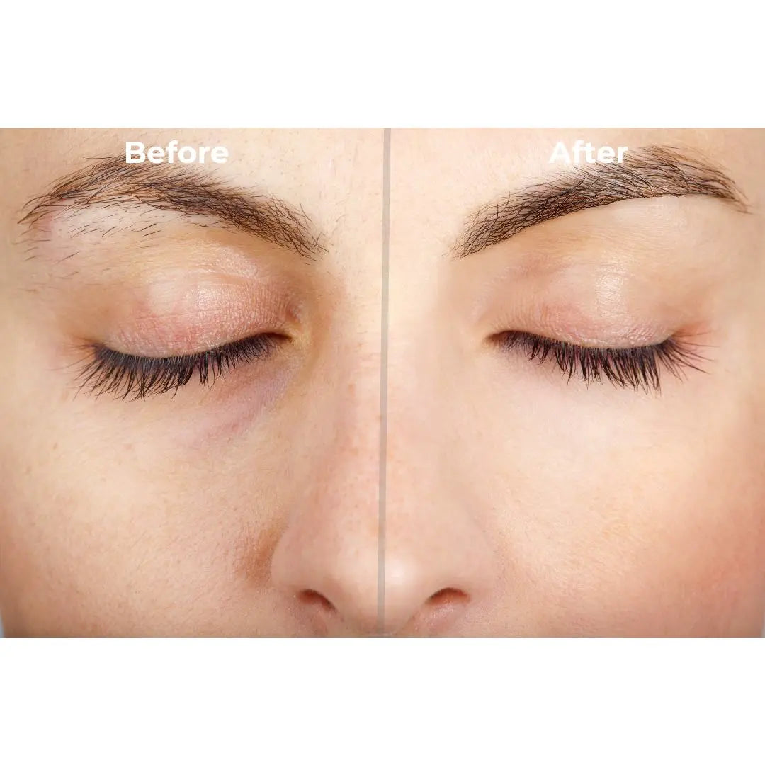 Haarentferner Stift Set